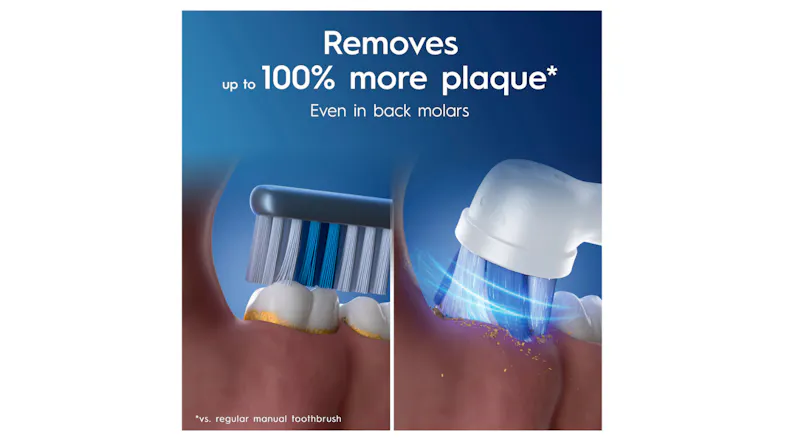 Side-by-side view of manual vs electric bristle cleaning of back molars Side-by-side view of manual vs electric bristle cleaning of back molars